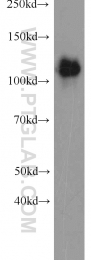 22709-1-AP - EMAP4 / EML4