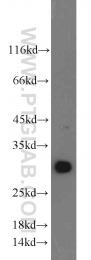 22148-1-AP - Endonuclease G