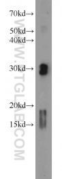 22148-1-AP - Endonuclease G
