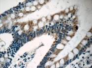 14243-1-AP - Autotaxin / ENPP2