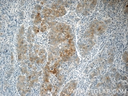 14243-1-AP - Autotaxin / ENPP2