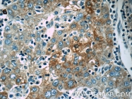 14243-1-AP - Autotaxin / ENPP2