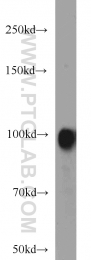14243-1-AP - Autotaxin / ENPP2