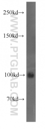 14243-1-AP - Autotaxin / ENPP2