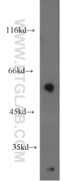 17305-1-AP - ENPP4