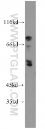 21010-1-AP - ENTPD8