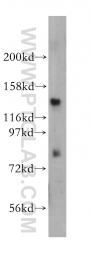 13014-1-AP - EPB41 / Protein 4.1