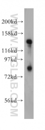 13014-1-AP - EPB41 / Protein 4.1