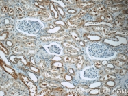 17908-1-AP - Erythropoietin / EPO