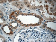 17908-1-AP - Erythropoietin / EPO