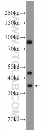 17908-1-AP - Erythropoietin / EPO