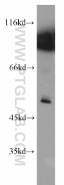 17908-1-AP - Erythropoietin / EPO