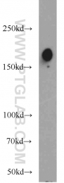 22438-1-AP - ERBB2IP / LAP2