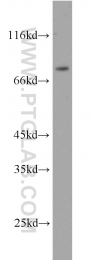 10818-1-AP - ERCC2