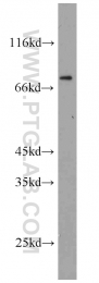 10818-1-AP - ERCC2