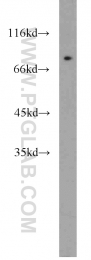 10818-1-AP - ERCC2