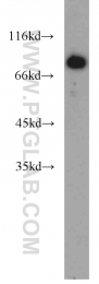 10818-1-AP - ERCC2