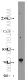 10818-1-AP - ERCC2