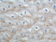 11261-2-AP - ERO1LB