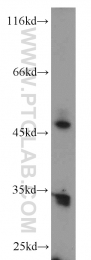 11261-2-AP - ERO1LB