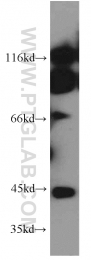 11261-2-AP - ERO1LB