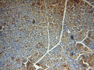 18312-1-AP - ERO1LB