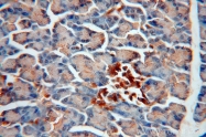 18312-1-AP - ERO1LB