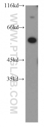 18312-1-AP - ERO1LB