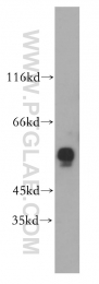 18312-1-AP - ERO1LB