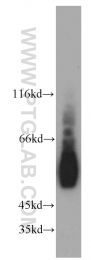 14007-1-AP - Estrogen receptor beta