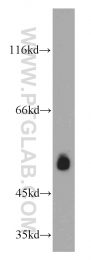 14007-1-AP - Estrogen receptor beta