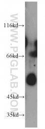 14007-1-AP - Estrogen receptor beta