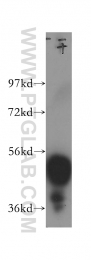 14007-1-AP - Estrogen receptor beta