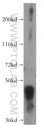 14007-1-AP - Estrogen receptor beta