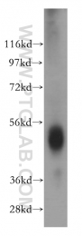 14007-1-AP - Estrogen receptor beta