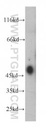 60197-1-Ig - Estrogen receptor beta