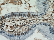 55441-1-AP - Estrogen receptor beta