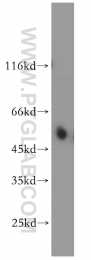 14017-1-AP - Estrogen-related receptor gamma
