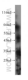 60115-1-Ig - Estrogen-related receptor gamma