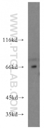 14657-1-AP - ESX1