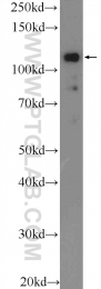 23201-1-AP - EVI1