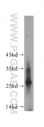 17415-1-AP - EVI2A