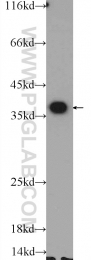 25292-1-AP - EXOSC7