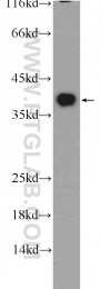 25292-1-AP - EXOSC7