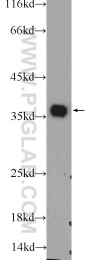 25292-1-AP - EXOSC7