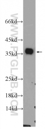 25292-1-AP - EXOSC7
