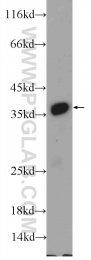 25292-1-AP - EXOSC7