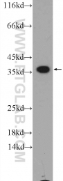 25292-1-AP - EXOSC7