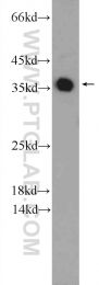 25292-1-AP - EXOSC7