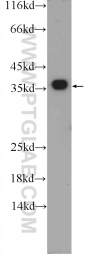 25292-1-AP - EXOSC7